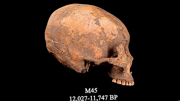 12.000 anni fa, un ragazzo aveva il cranio schiacciato a forma di cono. È la più antica prova di tale modellamento della testa.