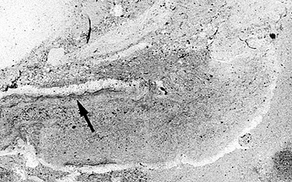 Súper autopista de gusanos de 500 millones de años revelada en el antiguo fondo marino