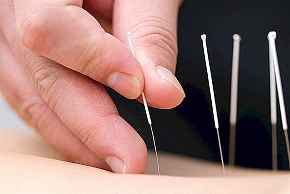 Acupunctuur veroorzaakt dat de long van de vrouw instort