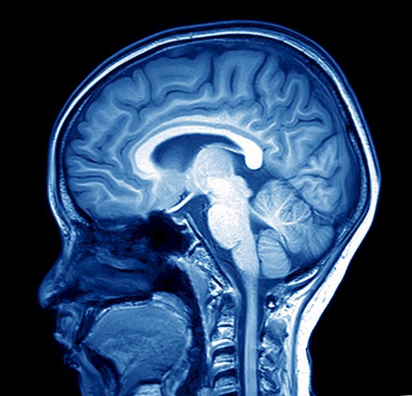 Jumlah Gray Grey di Otak Anda Dapat Memprediksi Jika Anda Akan Menempel Diet Anda