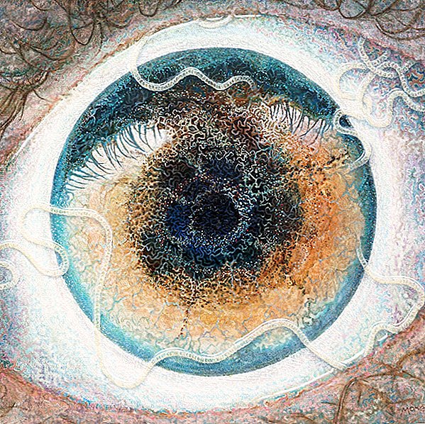 एक कलाकार ने अपनी आँख में एक परजीवी कृमि की खोज की, जिसे उन्होंने 'गाइडेड' हिज़ वर्क कहा