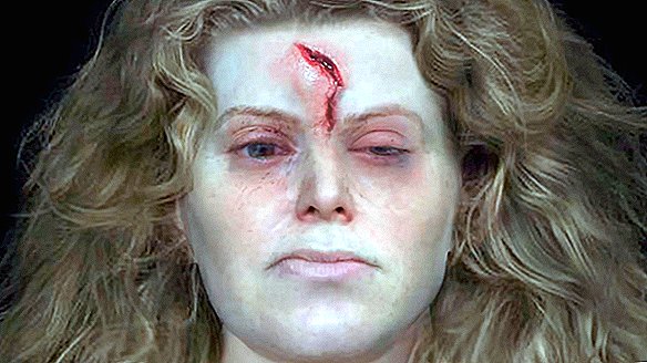 Scutul Viking-Scarred-Bătălia Obține Reconstrucția Facială pentru prima dată