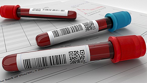Un test sanguin pourrait vous dire quelle heure il est dans votre corps