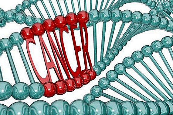 "جينات سرطان الثدي": ما مدى زيادة مخاطر الإصابة بالسرطان؟