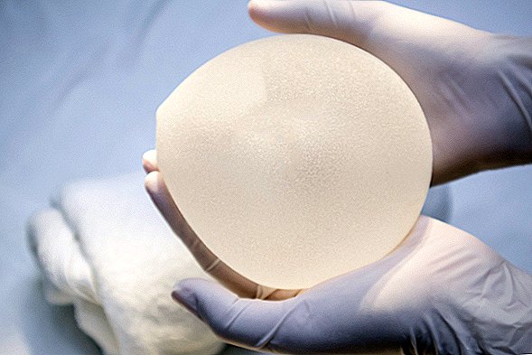 Implants mammaires liés à un cancer rare: quelle est l'ampleur du risque?