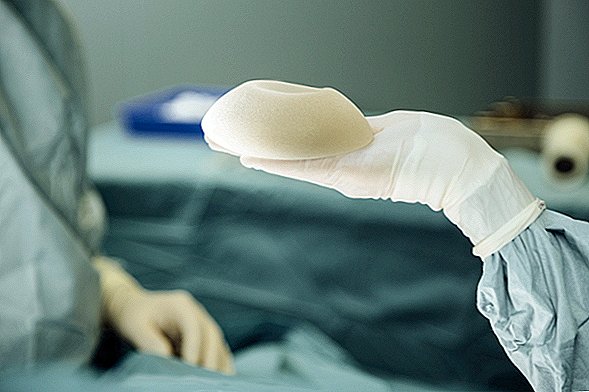 Implanty pośladkowe związane z rzadkim rakiem w pierwszym zgłoszonym przypadku