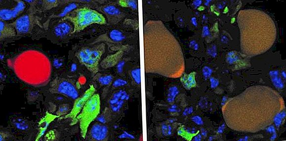 Rakovinové bunky transformované na neškodný tuk v štúdii na myšiach