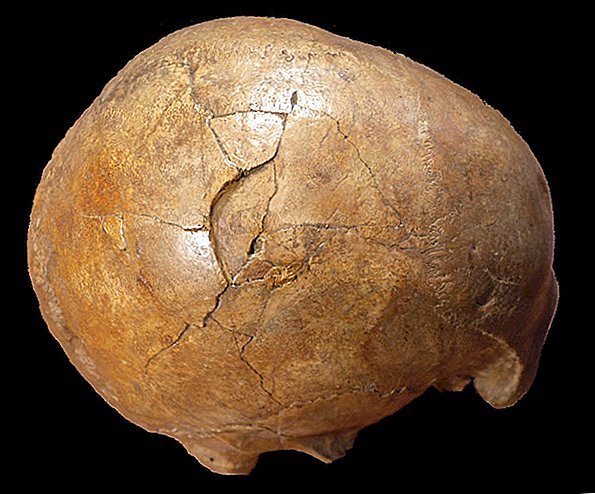 Caso frío cerrado: los científicos señalan el asesinato de 33,000 años en un asesino paleo zurdo