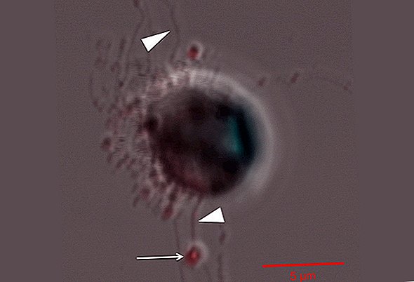 Les diatomées ont des relations sexuelles et l'ammonium est une excitation