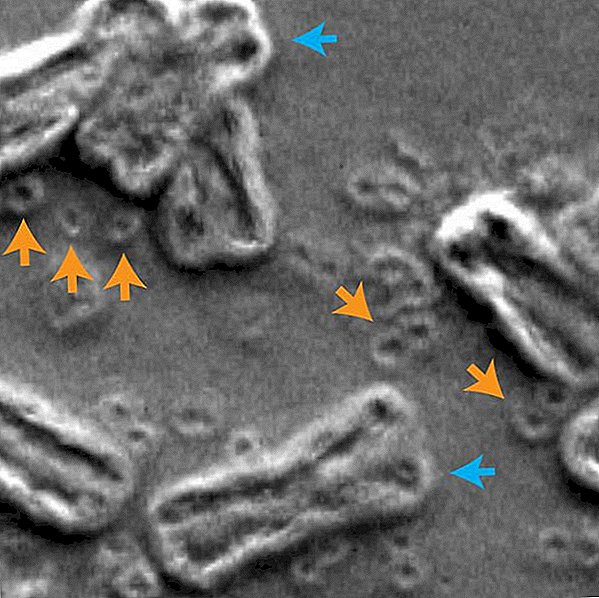 L'ADN en forme de beignet rend le cancer plus agressif