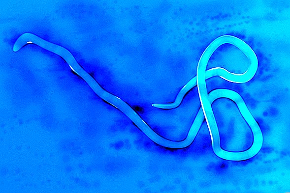 L'ebola lascia una cicatrice unica negli occhi dei sopravvissuti