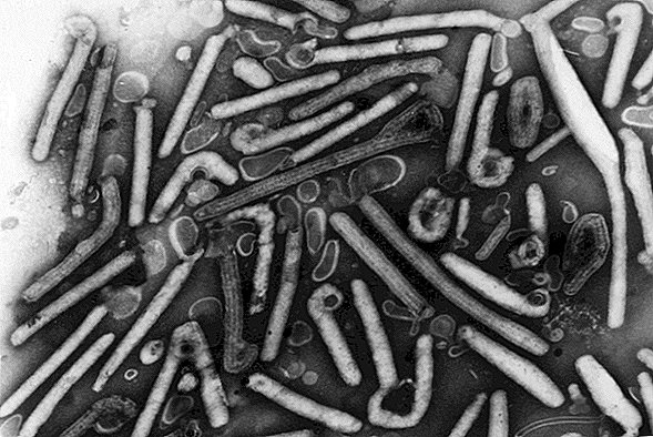 Ebola peut rester dans le sperme masculin pendant plus de 2 ans