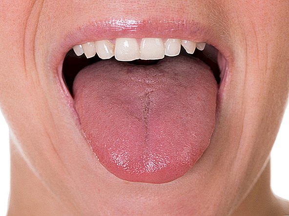 Eine fette Zunge kann Ihre Atemwege blockieren, während Sie schlafen