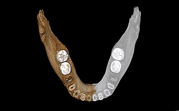 Encontrado: Primera evidencia tibetana de primos neandertales, los denisovanos