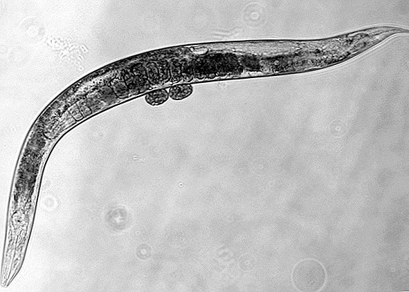 Tweak genético pode prolongar a vida de 500% (mas você precisa ser um verme)