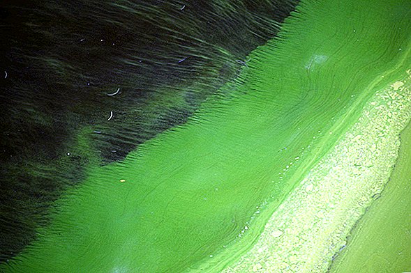 El limo verde pegajoso en las aguas de Florida es súper asqueroso y súper tóxico