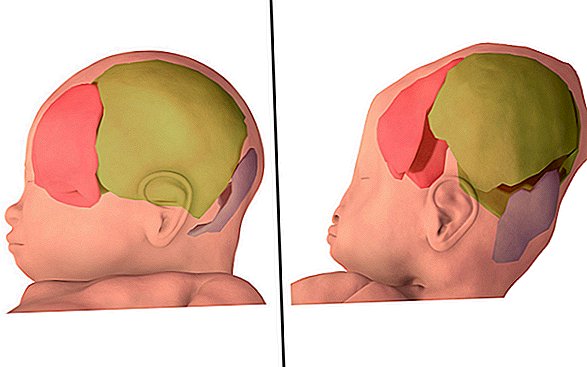 ¿Cuánto se aplastan los cráneos de los bebés durante el parto? Un lote completo, las imágenes en 3D revelan