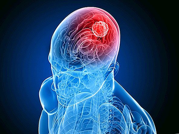 איך וירוס זיקה יכול לעזור במאבק בסרטן המוח