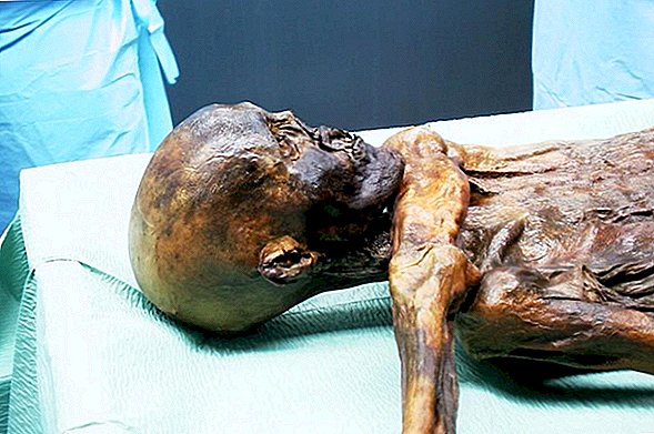 Iceman Mummy a souffert un coup de tête avant la mort