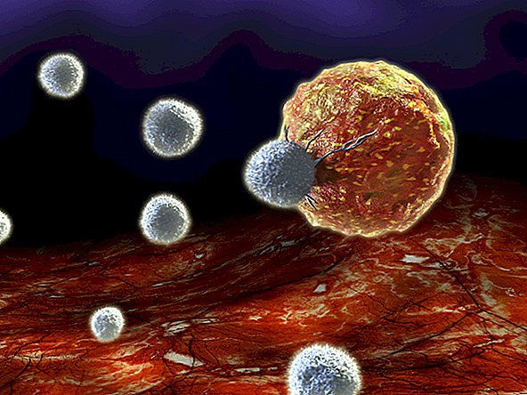 Imunitní systém: nemoci, poruchy a funkce