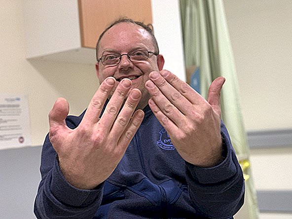 Dalam operasi yang jarang terjadi, rumah sakit menukar ibu jari yang hilang dengan jempol kaki