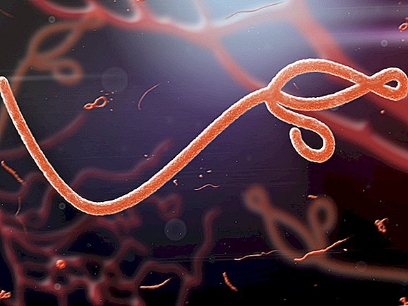 Japan hat gerade Ebola importiert, um sich auf einen möglichen olympischen Ausbruch vorzubereiten