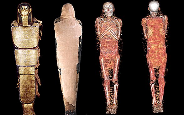 Mystery Mummy pudo haber sido el oftalmólogo personal del faraón