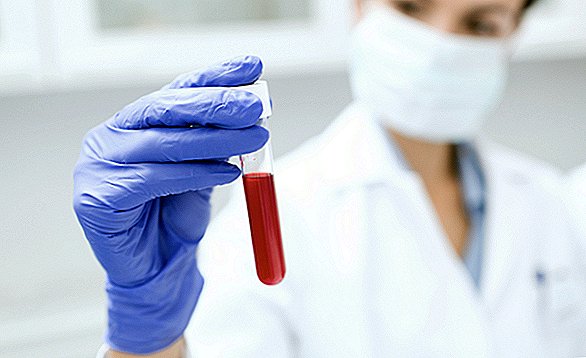 Nový krevní test dokáže detekovat 8 typů rakoviny