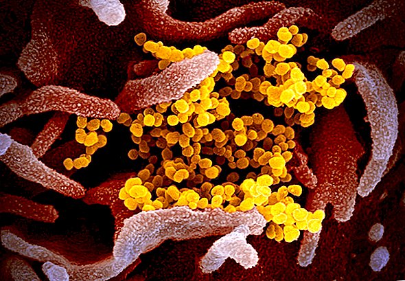 El nuevo coronavirus: sus preguntas respondidas