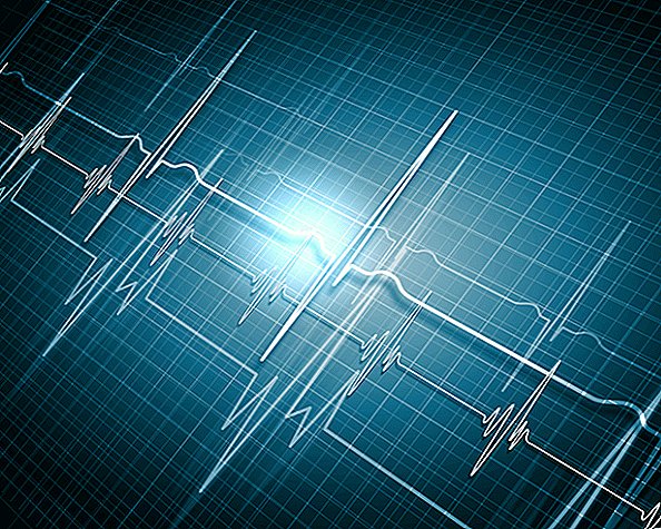 بيانات جهاز تنظيم ضربات القلب لاستخدامه كدليل تجريبي: ما الذي يمكن أن تظهره؟