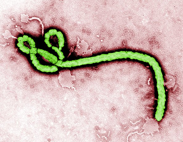 Paciente testado para Ebola na Pensilvânia