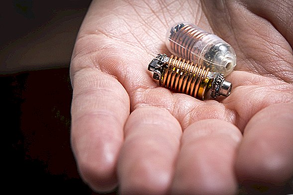 El sensor del tamaño de una pastilla olfatea gases a medida que pasa a través de su intestino