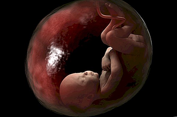 Las placentas están cubiertas de hollín del escape del automóvil. ¿Podría alcanzar el feto?
