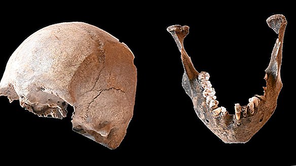 Plínio, o Velho, morreu na erupção do Monte Vesúvio em 79 dC. Este é o crânio dele?