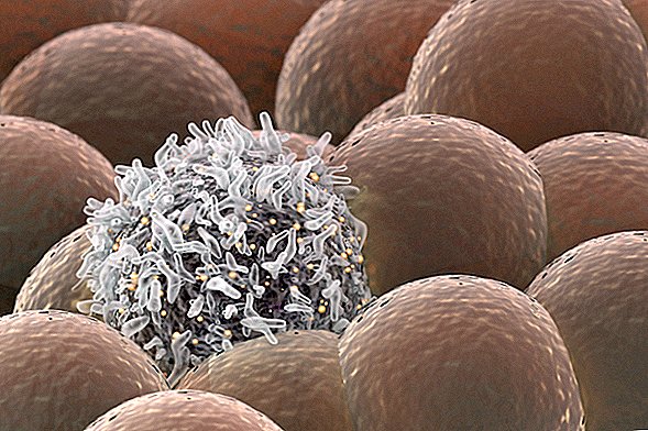 Los científicos desarrollan un nuevo láser que puede encontrar y destruir células cancerosas en la sangre