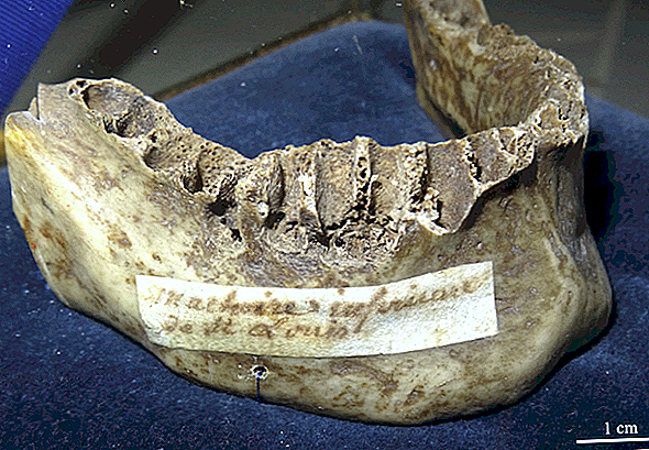 Des scientifiques découvrent le scorbut dans la bouche d'un roi des croisés décédé depuis longtemps