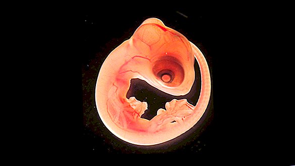 Para saintis 'terkejut' mendapati parasit otak dalam kadal bayi masih dalam kerang