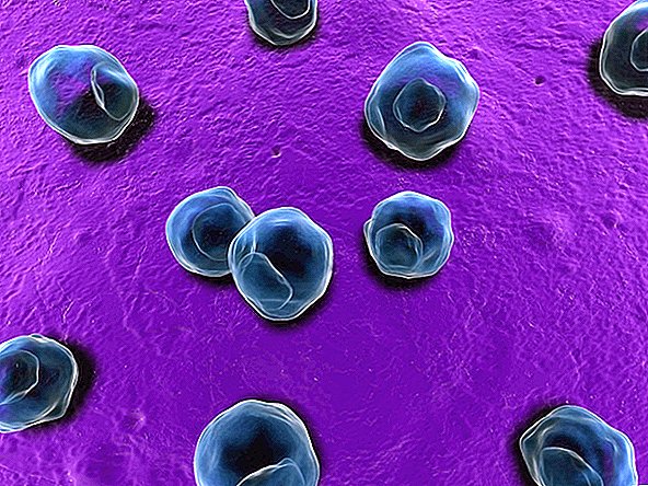 Niektoré vaginálne baktérie môžu zvýšiť riziko pohlavne prenosných chorôb