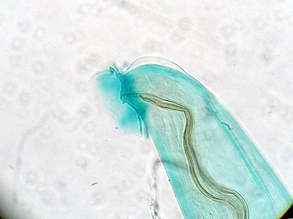 Trois cas de parasites infectant le cerveau récemment confirmés à Hawaï