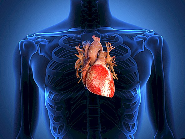 Trans tukov viazaných na menej srdcových záchvatov a mozgových príhod