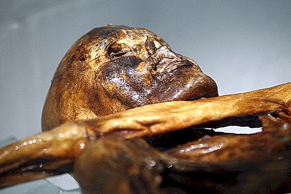 قد يكون الوشم Ötzi لرجل الثلج شكلاً بدائيًا للوخز بالإبر