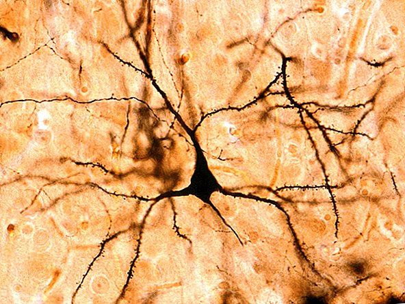 Un signal cérébral unique vient d'être découvert. Et cela pourrait nous rendre «humains»