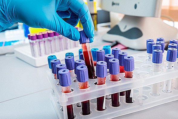 Oamenii de știință din SUA dezvoltă un test de sânge crucial pentru anticorpii coronavirus