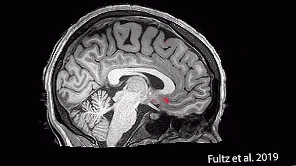 Vea cómo el líquido cefalorraquídeo 'lava' el cerebro dormido en ondas rítmicas y pulsantes