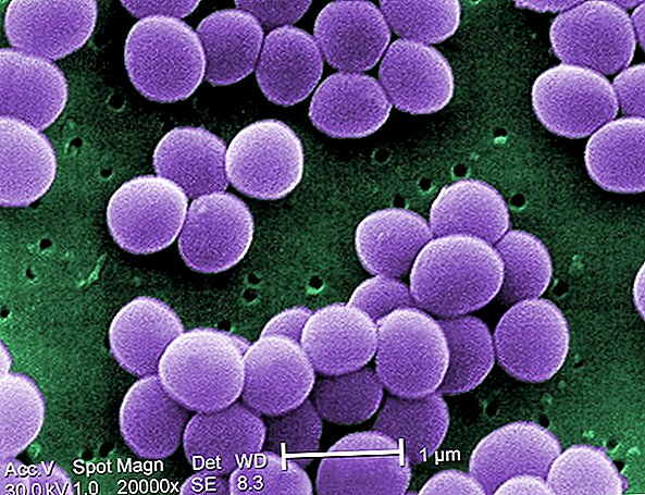 Що таке бактерії?