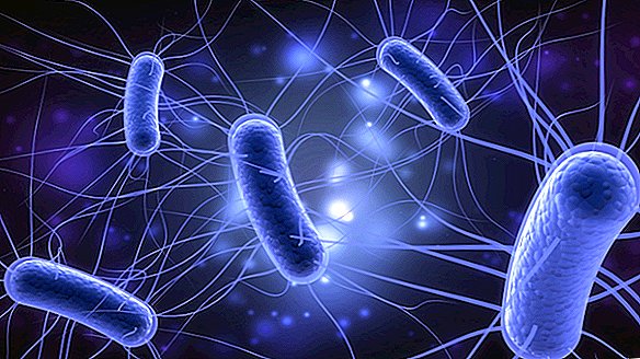 ¿Qué es E. coli?