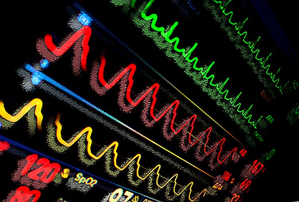 Warum haben mehr junge Menschen Herzinfarkte?