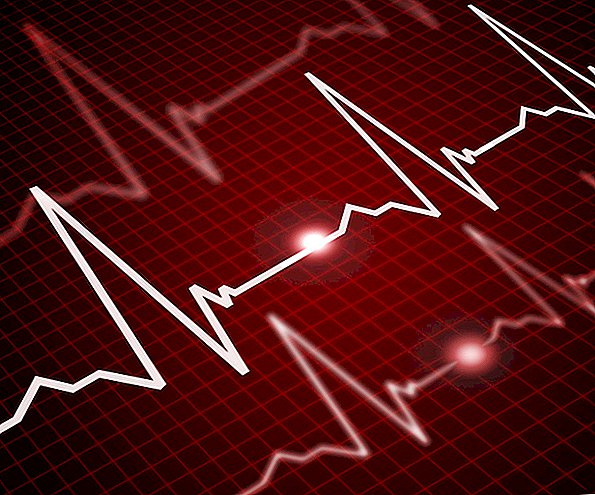 Mengapa Ujian Besar Mungkin Tanda Masalah Jantung Besar