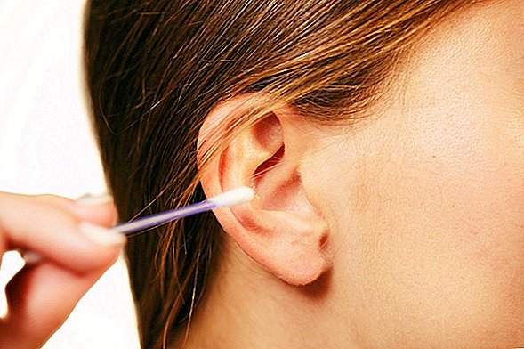 Mulher desenvolve horrível infecção craniana após limpar as orelhas com cotonetes