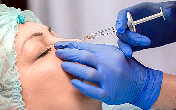 Vrouw's gezichtsinjectie voor 'Liquid Nose Job' gaf haar een zeldzaam oogprobleem